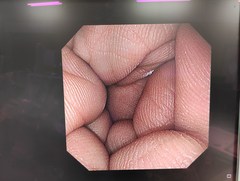 上部消化管汎用ビデオスコープ｜GIF-XP290N｜オリンパスメディカルシステムズ株式会社の写真6枚目
