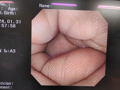 上部消化管汎用ビデオスコープ｜GIF-XP260NS｜オリンパスメディカルシステムズ株式会社の写真6枚目