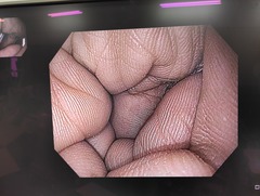 上部消化管汎用ビデオスコープ｜GIF-H190N｜オリンパスメディカルシステムズ株式会社の写真6枚目