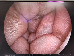 上部消化管用経鼻スコープ｜EG-580NW｜富士フイルムメディカルの写真6枚目