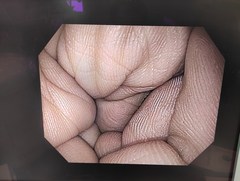 上部消化管汎用ビデオスコープ｜GIF-H190N｜オリンパスメディカルシステムズ株式会社の写真6枚目