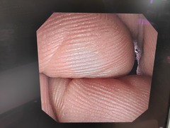 十二指腸ビデオスコープ｜TJF-260V｜オリンパスメディカルシステムズ株式会社の写真6枚目