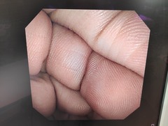 十二指腸ビデオスコープ｜TJF-260V｜オリンパスメディカルシステムズ株式会社の写真6枚目
