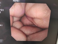 上部消化管汎用ビデオスコープ｜GIF-XP260NS｜オリンパスメディカルシステムズ株式会社の写真6枚目