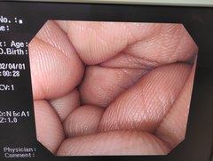 上部消化管汎用ビデオスコープ｜GIF-Q260｜オリンパスメディカルシステムズ株式会社の写真6枚目