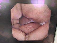 上部消化管汎用ビデオスコープ｜GIF-XP290N｜オリンパスメディカルシステムズ株式会社の写真6枚目