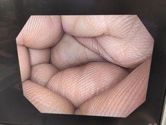 上部消化管汎用ビデオスコープ｜GIF-H170｜オリンパスメディカルシステムズ株式会社の写真6枚目