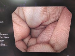 上部消化管汎用ビデオスコープ｜GIF-H260｜オリンパスメディカルシステムズ株式会社の写真6枚目