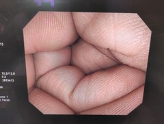 大腸ビデオスコープ｜CF-Q260AI｜オリンパスメディカルシステムズ株式会社の写真6枚目