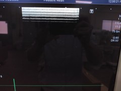 超音波診断装置｜Aplio 300 TUS−A300｜キヤノンメディカルシステムズの写真6枚目