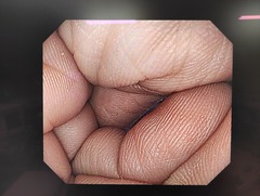上部消化管汎用ビデオスコープ｜GIF-H260Z｜オリンパスメディカルシステムズ株式会社の写真6枚目