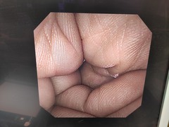 上部消化管汎用ビデオスコープ｜GIF-XP260NS｜オリンパスメディカルシステムズ株式会社の写真6枚目