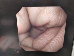 上部消化管汎用ビデオスコープ｜GIF-XQ240｜オリンパスメディカルシステムズ株式会社の写真6枚目
