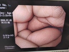 上部消化管汎用ビデオスコープ｜GIF-H260｜オリンパスメディカルシステムズ株式会社の写真6枚目