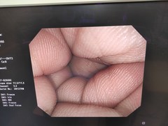 上部消化管汎用ビデオスコープ｜GIF-XQ260｜オリンパスメディカルシステムズ株式会社の写真6枚目