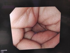 上部消化管汎用ビデオスコープ｜GIF-H260Z｜オリンパスメディカルシステムズ株式会社の写真6枚目
