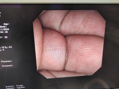 十二指腸ビデオスコープ｜JF-240｜オリンパスメディカルシステムズ株式会社の写真6枚目