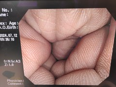 大腸ビデオスコープ｜CF-Q240I｜オリンパスメディカルシステムズ株式会社の写真6枚目