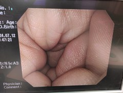 上部消化管汎用ビデオスコープ｜GIF-Q240X｜オリンパスメディカルシステムズ株式会社の写真6枚目