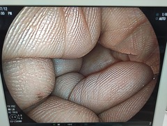 上部消化管用経鼻スコープ｜EG-L580NW｜富士フイルムメディカルの写真6枚目