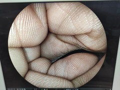 大腸ビデオスコープ｜EC-590WM3｜富士フイルムメディカルの写真6枚目