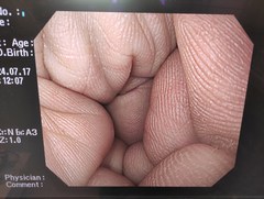 上部消化管汎用ビデオスコープ｜GIF-H260｜オリンパスメディカルシステムズ株式会社の写真6枚目