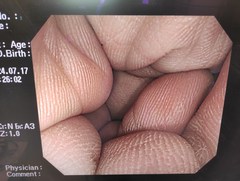 大腸ビデオスコープ｜CF-H260AI｜オリンパスメディカルシステムズ株式会社の写真6枚目