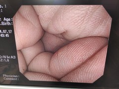 大腸ビデオスコープ｜CF-H260AZI｜オリンパスメディカルシステムズ株式会社の写真6枚目