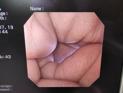 上部消化管汎用ビデオスコープ｜GIF-XQ240｜オリンパスメディカルシステムズ株式会社の写真6枚目