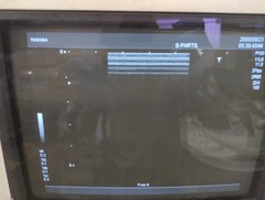 超音波診断装置（白黒）｜SSA-550A Nemio10｜キヤノンメディカルシステムズの写真6枚目