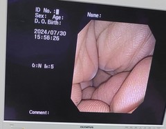 上部消化管汎用ビデオスコープ(径鼻)｜GIF-XP150N｜オリンパスメディカルシステムズ株式会社の写真6枚目