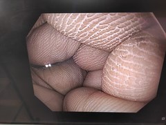 上部消化管汎用ビデオスコープ｜GIF-H190N｜オリンパスメディカルシステムズ株式会社の写真6枚目