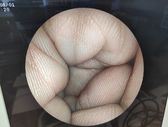 上部消化管用経鼻スコープ｜EG-3000N｜富士フイルムメディカルの写真6枚目