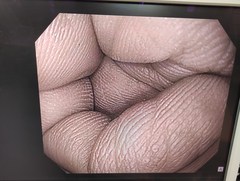 上部消化管汎用ビデオスコープ｜GIF-Q150X｜オリンパスメディカルシステムズ株式会社の写真6枚目