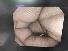 大腸ビデオスコープ｜PCF-Q150AI｜オリンパスメディカルシステムズ株式会社の写真6枚目