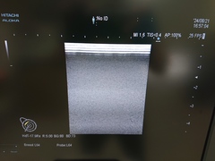超音波診断装置（カラードプラ）｜ARIETTA 70｜日立製作所の写真6枚目