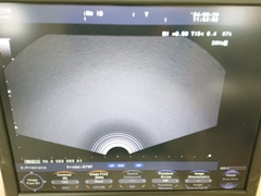 超音波診断装置｜F37｜日立製作所の写真6枚目