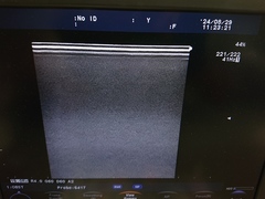 超音波診断装置｜F37｜日立製作所の写真6枚目