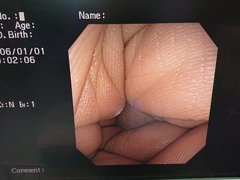 上部消化管汎用ビデオスコープ(径鼻)｜GIF-XP150N｜オリンパスメディカルシステムズ株式会社の写真6枚目
