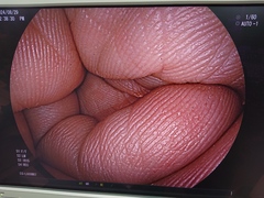 上部消化管用スコープ｜EG-L600WR7｜富士フイルムメディカルの写真6枚目