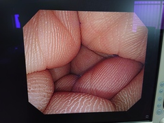 大腸ビデオスコープ｜PCF-PQ260L｜オリンパスメディカルシステムズ株式会社の写真6枚目