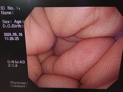 上部消化管汎用ビデオスコープ｜GIF-Q260｜オリンパスメディカルシステムズ株式会社の写真6枚目