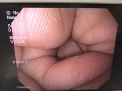 上部消化管汎用ビデオスコープ｜GIF-Q140｜オリンパスメディカルシステムズ株式会社の写真6枚目