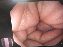 上部消化管汎用ビデオスコープ｜GIF-HQ290｜オリンパスメディカルシステムズ株式会社の写真6枚目