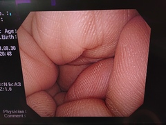 上部消化管汎用ビデオスコープ｜GIF-Q260｜オリンパスメディカルシステムズ株式会社の写真6枚目