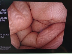 大腸ビデオスコープ｜CF-H260AZI｜オリンパスメディカルシステムズ株式会社の写真6枚目
