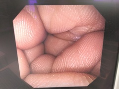 上部消化管汎用ビデオスコープ｜GIF-XP290N｜オリンパスメディカルシステムズ株式会社の写真6枚目