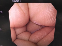 上部消化管汎用ビデオスコープ｜GIF-XQ240｜オリンパスメディカルシステムズ株式会社の写真6枚目