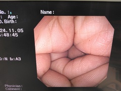Video Colonoscope｜CF-240I｜Olympus Medical Systems photo6