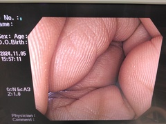 Video Colonoscope｜PCF-Q240ZI｜Olympus Medical Systems photo6